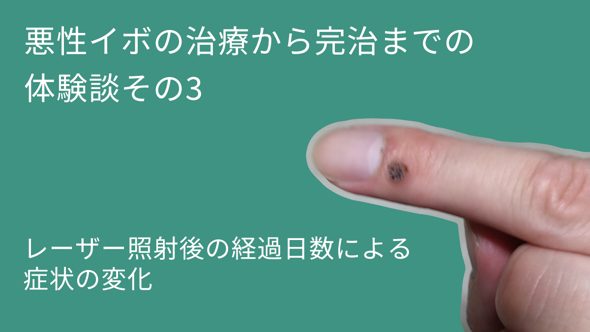 悪性イボが治るまで体験談